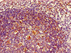 Immunohistochemistry of paraffin-embedded human tonsil tissue using CSB-PA17949D0Rb at dilution of 1:100