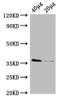 Western Blot<br />
 Positive WB detected in: Rosseta bacteria lysate at 40μg, 20μg<br />
 All lanes: dcyD antibody; HRP conjugated at 0.42µg/ml<br />
 Predicted band size: 36 kDa<br />
 Observed band size: 36 kDa<br />