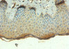 Immunohistochemistry of paraffin-embedded human skin tissue using CSB-PA18049A0Rb at dilution of 1:100