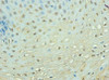 Immunohistochemistry of paraffin-embedded human esophageal tissue using CSB-PA18049A0Rb at dilution of 1: 100