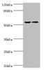 Western blot<br />
 All lanes: CASP8 antibody at 2µg/ml<br />
 Lane 1: ACCM whole cell lysate<br />
 Lane 2: LO2 whole cell lysate<br />
 Secondary<br />
 Goat polyclonal to rabbit IgG at 1/10000 dilution<br />
 Predicted band size: 56, 54, 46, 58, 28, 26, 33, 31, 62 kDa<br />
 Observed band size: 56 kDa<br />