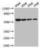 Western Blot<br />
 Positive WB detected in: Rosseta bacteria lysate at 80μg, 40μg, 20μg, 10μg<br />
 All lanes: glpK antibody at 3µg/ml<br />
 Secondary<br />
 Goat polyclonal to rabbit IgG at 1/50000 dilution<br />
 Predicted band size: 57 kDa<br />
 Observed band size: 57 kDa<br />