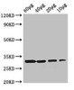 Western Blot<br />
 Positive WB detected in: Rosseta bacteria lysate at 80μg, 40μg, 20μg, 10μg<br />
 All lanes: rbsK antibody at 3µg/ml<br />
 Secondary<br />
 Goat polyclonal to rabbit IgG at 1/50000 dilution<br />
 Predicted band size: 33 kDa<br />
 Observed band size: 33 kDa<br />