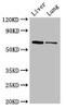 Western Blot<br />
 Positive WB detected in: Mouse liver tissue, Rat lung tissue<br />
 All lanes: Ces1c antibody at 5µg/ml<br />
 Secondary<br />
 Goat polyclonal to rabbit IgG at 1/50000 dilution<br />
 Predicted band size: 62 kDa<br />
 Observed band size: 62 kDa<br />