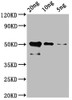 Western blot<br />
 All lanes: cry1Ac antibody at 2µg/ml + Recombinant Bacillus thuringiensis subsp. kurstaki Pesticidal crystal protein cry1Ac protein at 1µg<br />
 Secondary<br />
 Goat polyclonal to rabbit IgG at 1/10000 dilution<br />
 Predicted band size: 134 kDa<br />
 Observed band size: 134 kDa<br />