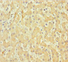 Immunohistochemistry of paraffin-embedded human liver tissue using CSB-PA409861LA01HU at dilution of 1:100