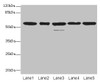 Western blot<br />
 All lanes: RBBP4 antibody at 1µg/ml<br />
 Lane 1: Hela whole cell lysate<br />
 Lane 2: LO2 whole cell lysate<br />
 Lane 3: K562 whole cell lysate<br />
 Lane 4: NIH/3T3 whole cell lysate<br />
 Lane 5: Raji whole cell lysate<br />
 Secondary<br />
 Goat polyclonal to rabbit IgG at 1/10000 dilution<br />
 Predicted band size: 48, 47, 44 kDa<br />
 Observed band size: 48, 55 kDa<br />