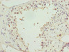 Immunohistochemistry of paraffin-embedded human testis tissue using CSB-PA600201LA01HU at dilution of 1:100