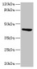Western blot<br />
 All lanes: ST3GAL3 antibody at 2µg/ml + Mouse skeletal muscle tissue<br />
 Secondary<br />
 Goat polyclonal to rabbit lgG at 1/15000 dilution<br />
 Predicted band size: 43, 44, 20, 50, 39, 22, 32, 13, 21, 14, 18, 49, 17, 41, 31, 16, 47, 26, 27, 12, 23, 6, 9 kDa<br />
 Observed band size: 43 kDa<br />