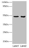 Western blot<br />
 All lanes: SKP2 antibody at 2µg/ml<br />
 Lane 1: Jurkat whole cell lysate<br />
 Lane 2: Hela whole cell lysate<br />
 Secondary<br />
 Goat polyclonal to rabbit IgG at 1/10000 dilution<br />
 Predicted band size: 48, 47, 24 kDa<br />
 Observed band size: 48 kDa<br />