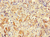 Immunohistochemistry of paraffin-embedded human lung tissue using CSB-PA613490HA01HU at dilution of 1:100 Immunohistochemistry of paraffin-embedded human lung tissue using CSB-PA613490HA01HU at dilution of 1:100