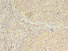Immunohistochemistry of paraffin-embedded human tonsil tissue using CSB-PA613521LA01HU at dilution of 1:100