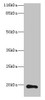 Western blot<br />
 All lanes: RAB30 antibody at 1µg/ml + Hela whole cell lysate<br />
 Secondary<br />
 Goat polyclonal to rabbit IgG at 1/10000 dilution<br />
 Predicted band size: 24, 19 kDa<br />
 Observed band size: 19 kDa<br />