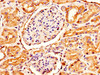 IHC image of CSB-PA613693LA01HU diluted at 1:300 and staining in paraffin-embedded human kidney tissue performed on a Leica BondTM system. After dewaxing and hydration, antigen retrieval was mediated by high pressure in a citrate buffer (pH 6.0) . Section was blocked with 10% normal goat serum 30min at RT. Then primary antibody (1% BSA) was incubated at 4°C overnight. The primary is detected by a biotinylated secondary antibody and visualized using an HRP conjugated SP system.
