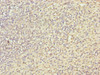 Immunohistochemistry of paraffin-embedded human spleen tissue using CSB-PA613705LA01HU at dilution of 1:100