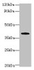 Western blot<br />
 All lanes: PRPSAP1 antibody at 4µg/ml + Hela whole cell lysate<br />
 Secondary<br />
 Goat polyclonal to rabbit IgG at 1/10000 dilution<br />
 Predicted band size: 40, 43 kDa<br />
 Observed band size: 40 kDa<br />