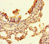 Immunohistochemistry of paraffin-embedded human lung tissue using CSB-PA614827LA01HU at dilution of 1:100