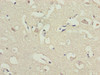 Immunohistochemistry of paraffin-embedded human brain tissue using CSB-PA614878LA01HU at dilution of 1:100