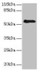 Western blot<br />
 All lanes: RBMY1F antibody at 2µg/ml + PC-3 whole cell lysate<br />
 Secondary<br />
 Goat polyclonal to rabbit IgG at 1/10000 dilution<br />
 Predicted band size: 56, 48 kDa<br />
 Observed band size: 56 kDa<br />