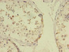 Immunohistochemistry of paraffin-embedded human testis tissue using CSB-PA614891LA01HU at dilution of 1:100