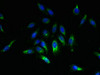 Immunofluorescent analysis of Hela cells using CSB-PA617993LA01HU at dilution of 1:100 and Alexa Fluor 488-congugated AffiniPure Goat Anti-Rabbit IgG (H+L)
