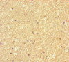 Immunohistochemistry of paraffin-embedded human brain tissue using CSB-PA617994LA01HU at dilution of 1:100