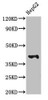 Western Blot<br />
 Positive WB detected in: HepG2 whole cell lysate<br />
 All lanes: MADCAM1 antibody at 3µg/ml<br />
 Secondary<br />
 Goat polyclonal to rabbit IgG at 1/50000 dilution<br />
 Predicted band size: 41, 29, 32, 22 kDa<br />
 Observed band size: 41 kDa<br />