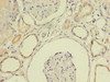 Immunohistochemistry of paraffin-embedded human kidney tissue using CSB-PA619076LA01HU at dilution of 1:100