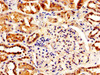 IHC image of CSB-PA622779LA01HU diluted at 1:500 and staining in paraffin-embedded human kidney tissue performed on a Leica BondTM system. After dewaxing and hydration, antigen retrieval was mediated by high pressure in a citrate buffer (pH 6.0) . Section was blocked with 10% normal goat serum 30min at RT. Then primary antibody (1% BSA) was incubated at 4°C overnight. The primary is detected by a biotinylated secondary antibody and visualized using an HRP conjugated SP system.