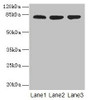 Western blot<br />
 All lanes: ACAP1 antibody at 4µg/ml<br />
 Lane 1: Mouse lung tissue<br />
 Lane 2: Jurkat whole cell lysate<br />
 Lane 3: K562 whole cell lysate<br />
 Secondary<br />
 Goat polyclonal to rabbit IgG at 1/10000 dilution<br />
 Predicted band size: 82 kDa<br />
 Observed band size: 82 kDa<br />
