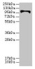 Western blot<br />
 All lanes: HKDC1 antibody at 4µg/ml + U87 whole cell lysate<br />
 Secondary<br />
 Goat polyclonal to rabbit IgG at 1/10000 dilution<br />
 Predicted band size: 103, 91, 83 kDa<br />
 Observed band size: 103 kDa<br />