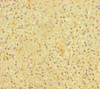 Immunohistochemistry of paraffin-embedded human adrenal gland tissue using CSB-PA668784LA01HU at dilution of 1:100