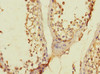 Immunohistochemistry of paraffin-embedded human testis tissue using CSB-PA674326LA01HU at dilution of 1:100