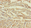 Immunohistochemistry of paraffin-embedded human heart tissue using CSB-PA705160LA01HU at dilution of 1:100
