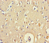 Immunohistochemistry of paraffin-embedded human brain tissue using CSB-PA705160LA01HU at dilution of 1:100