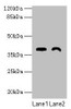 Western blot<br />
 All lanes: TMEM255A antibody at 6µg/ml<br />
 Lane 1: Mouse stomach tissue<br />
 Lane 2: Mouse heart tissue<br />
 Secondary<br />
 Goat polyclonal to rabbit IgG at 1/10000 dilution<br />
 Predicted band size: 39, 21, 36, 27 kDa<br />
 Observed band size: 39 kDa<br />