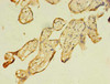 Immunohistochemistry of paraffin-embedded human placenta tissue using CSB-PA709599LA01HU at dilution of 1:100