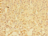 Immunohistochemistry of paraffin-embedded human adrenal gland tissue using CSB-PA716341LA01HU at dilution of 1:100