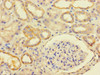 Immunohistochemistry of paraffin-embedded human kidney tissue using CSB-PA719466LA01HU at dilution of 1:100