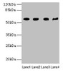 Western blot<br />
 All lanes: KRT79 antibody at 1µg/ml<br />
 Lane 1: Mouse lung tissue<br />
 Lane 2: A549 whole cell lysate<br />
 Lane 3: 293T whole cell lysate<br />
 Lane 4: Mouse gonadal tissue<br />
 Secondary<br />
 Goat polyclonal to rabbit IgG at 1/10000 dilution<br />
 Predicted band size: 58 kDa<br />
 Observed band size: 58 kDa<br />