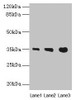 Western blot<br />
 All lanes: PVRIG antibody at 4µg/ml<br />
 Lane 1: Mouse liver tissue<br />
 Lane 2: Mouse kidney tissue<br />
 Lane 3: Mouse heart tissue<br />
 Secondary<br />
 Goat polyclonal to rabbit IgG at 1/10000 dilution<br />
 Predicted band size: 35 kDa<br />
 Observed band size: 35 kDa<br />