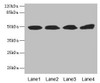 Western blot<br />
 All lanes: TBCEL antibody at 12µg/ml<br />
 Lane 1: Rat gonadal tissue<br />
 Lane 2: PC-3 whole cell lysate<br />
 Lane 3: Rat heart tissue<br />
 Lane 4: 293T whole cell lysate<br />
 Secondary<br />
 Goat polyclonal to rabbit IgG at 1/10000 dilution<br />
 Predicted band size: 49 kDa<br />
 Observed band size: 49 kDa<br />