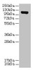 Western blot<br />
 All lanes: DENND2C antibody at 8µg/ml + A431 whole cell lysate<br />
 Secondary<br />
 Goat polyclonal to rabbit IgG at 1/10000 dilution<br />
 Predicted band size: 107, 95, 101 kDa<br />
 Observed band size: 107 kDa<br />