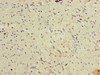 Immunohistochemistry of paraffin-embedded human colon tissue using CSB-PA726395LA01HU at dilution of 1:100