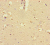 Immunohistochemistry of paraffin-embedded human brain tissue using CSB-PA727857LA01HU at dilution of 1:100