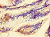 Immunohistochemistry of paraffin-embedded human small intestine tissue using CSB-PA730146LA01HU at dilution of 1:100