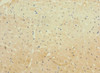 Immunohistochemistry of paraffin-embedded human heart tissue using CSB-PA743592LA01HU at dilution of 1:100