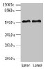 Western blot<br />
 All lanes: SLC30A6 antibody at 6µg/ml<br />
 Lane 1: A549 whole cell lysate<br />
 Lane 2: U251 whole cell lysate<br />
 Secondary<br />
 Goat polyclonal to rabbit IgG at 1/10000 dilution<br />
 Predicted band size: 52, 56, 48, 49 kDa<br />
 Observed band size: 52 kDa<br />