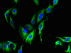 Immunofluorescent analysis of Hela cells using CSB-PA745763LA01HU at dilution of 1:100 and Alexa Fluor 488-congugated AffiniPure Goat Anti-Rabbit IgG (H+L) Immunofluorescent analysis of Hela cells using CSB-PA745763LA01HU at dilution of 1:100 and Alexa Fluor 488-congugated AffiniPure Goat Anti-Rabbit IgG (H+L)