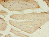 Immunohistochemistry of paraffin-embedded human skeletal muscle tissue using CSB-PA755482LA01HU at dilution of 1:100